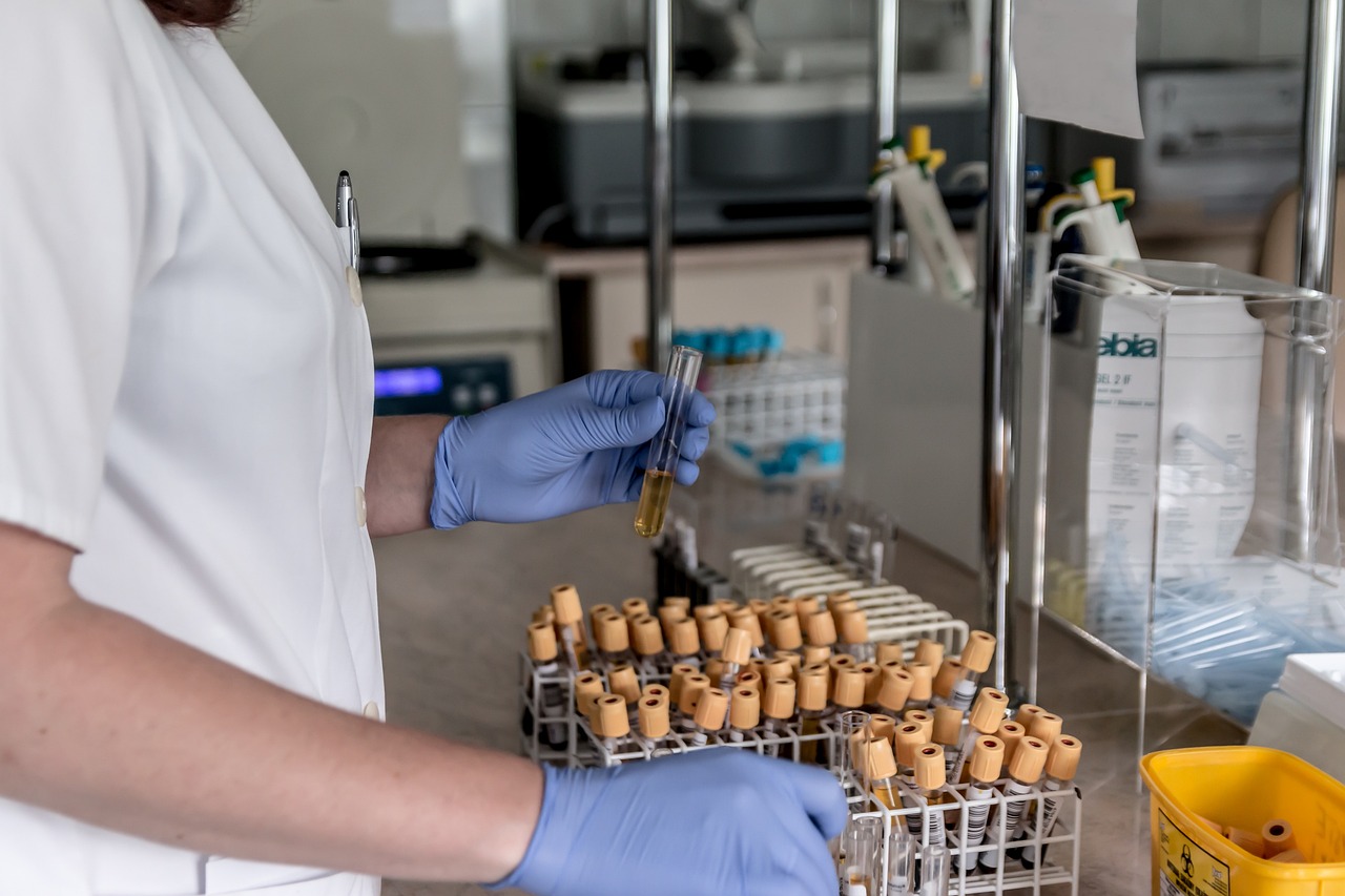 lab, analysis, diagnostics, hospital, test tube, test, tests, medical, the doctor, test tubes, medic, treatment, patient, diagnostician, health