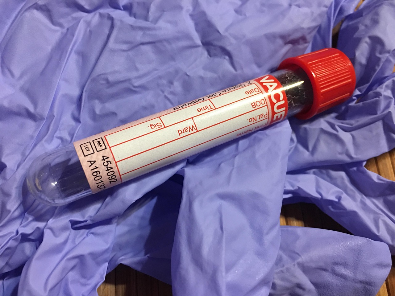 test tube, download, lab, test, diagnostics, diagnostician, medical, hospital, diagnosis, tests, glove, needle, syringe, set, closed system, blood cell